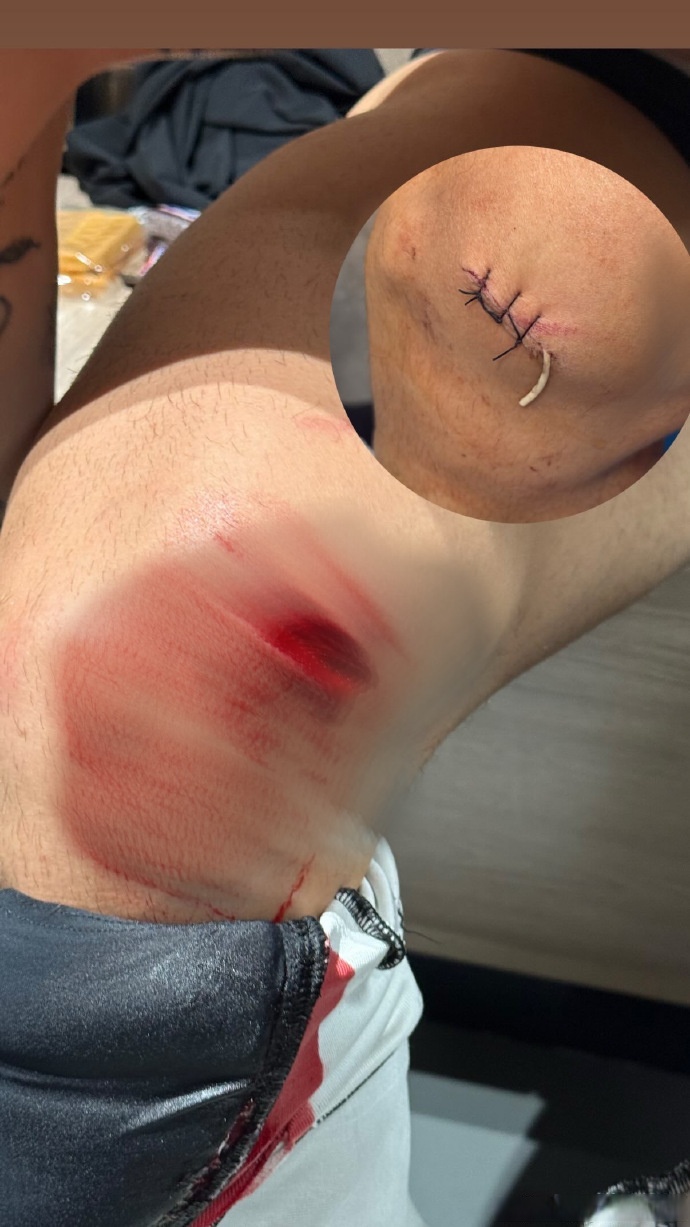 包含感动瞬间揪心人,受伤选手坚持到最后一刻的词条 包含感动瞬间揪心人,受伤选手坚持到最后一刻的词条